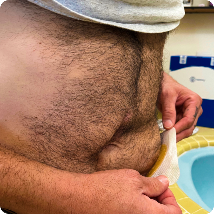 Testa di un uomo con un cappello