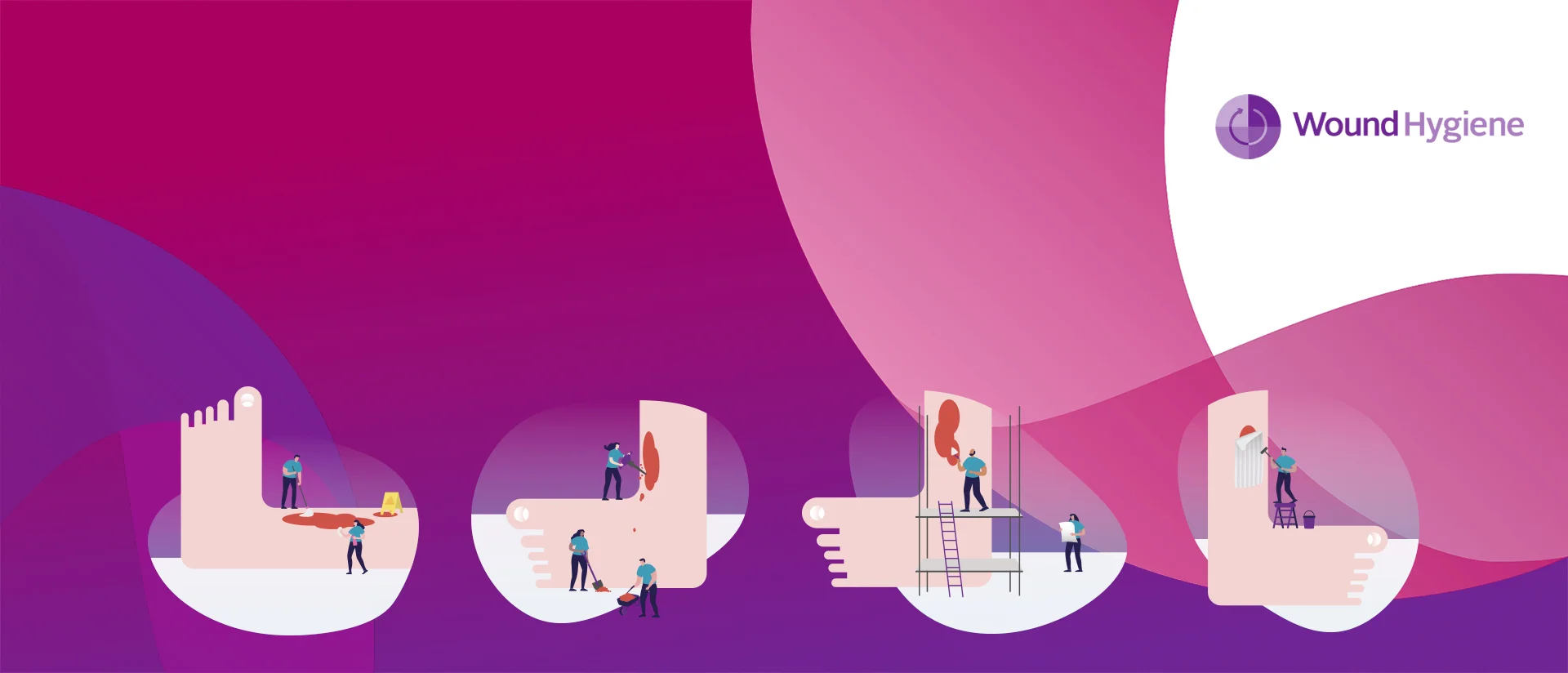 Adım adım iyileşme sürecini temsil eden dev bir ayak üzerinde çalışan insanların bir dizi illüstrasyonu. Resmin üzerine "Yara Hijyeni" yazısı yerleştirilmiştir.