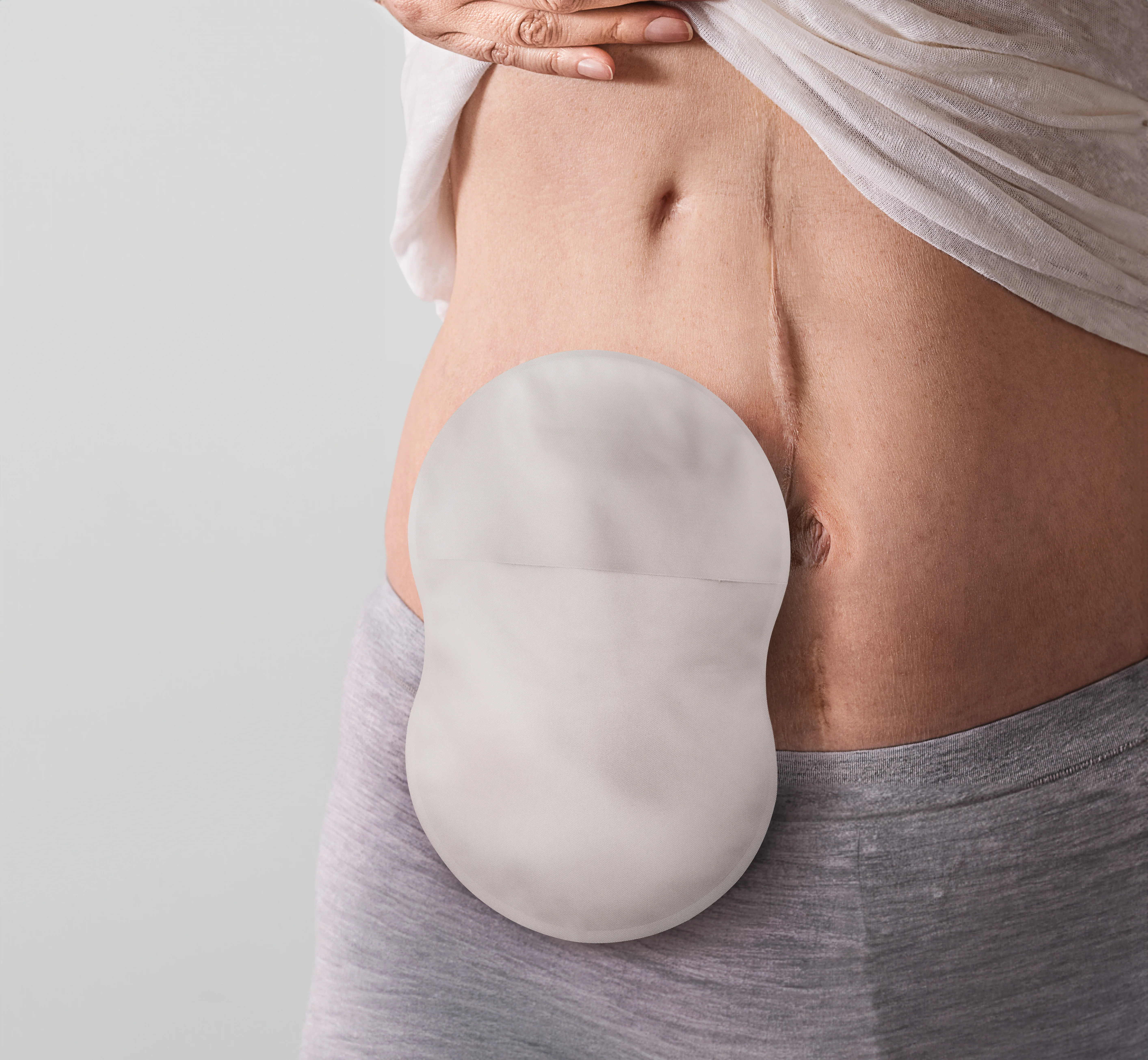 Frau, die einen Stomabeutel von Esteem Body™ trägt