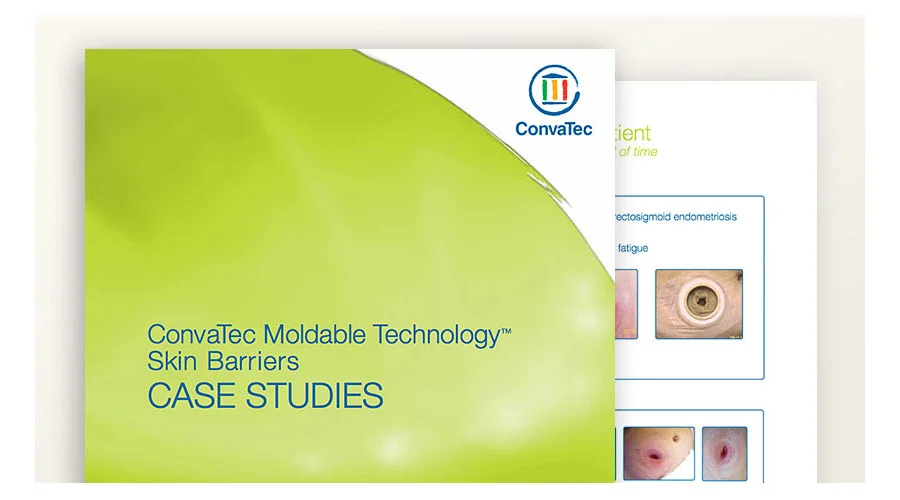 interface gráfica do usuário