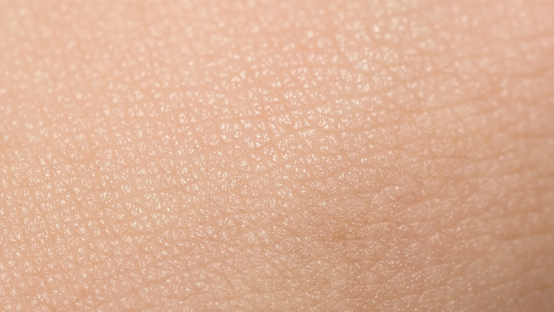 Leakages and Stoma skin LP skin 3